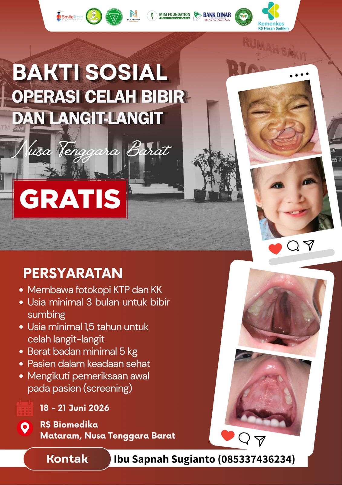 BAKTI SOSIAL OPERASI CELAH BIBIR DAN LANGIT-LANGIT GRATIS DI RS BIOMEDIKA MATARAM